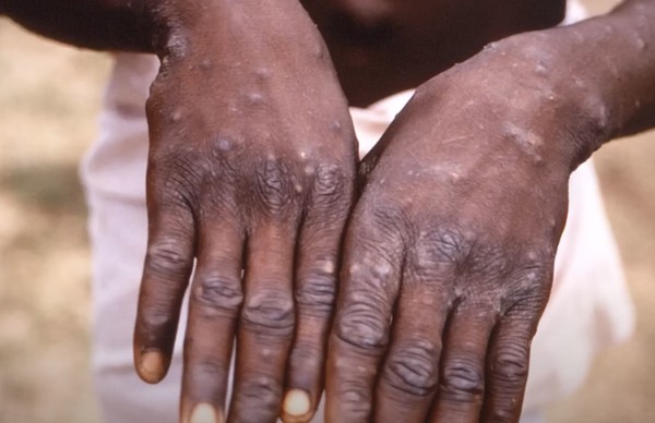 사진=MBCNEWS 유튜브 캡처