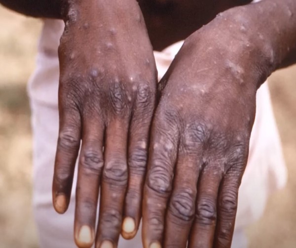 사진=MBCNEWS 유튜브 캡처