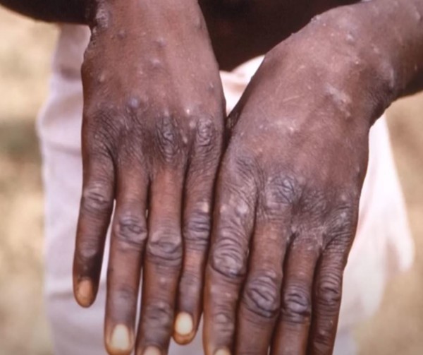 사진=MBCNEWS 유튜브 캡처